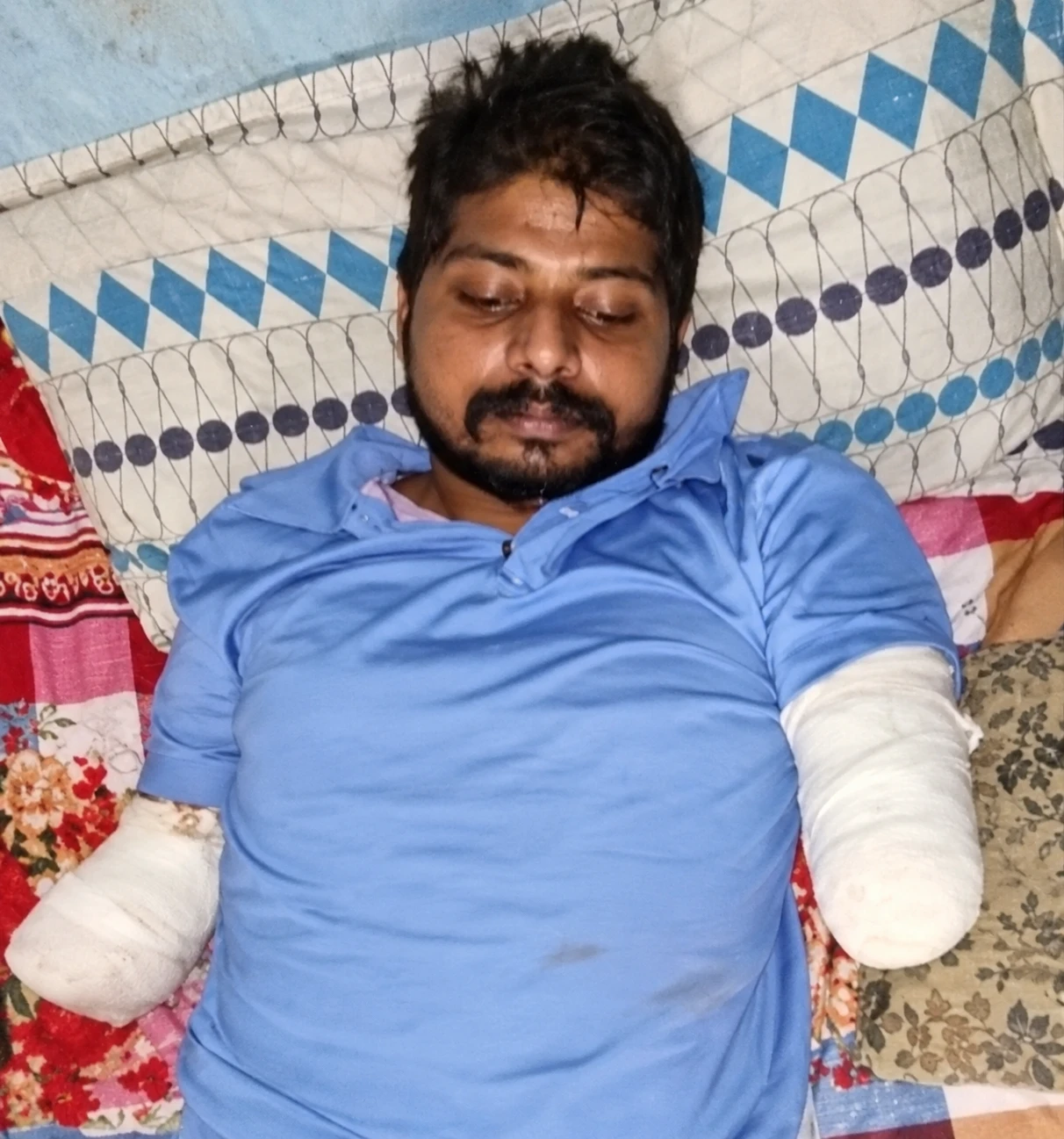 Sunil dopo l’incidente nel 2022.